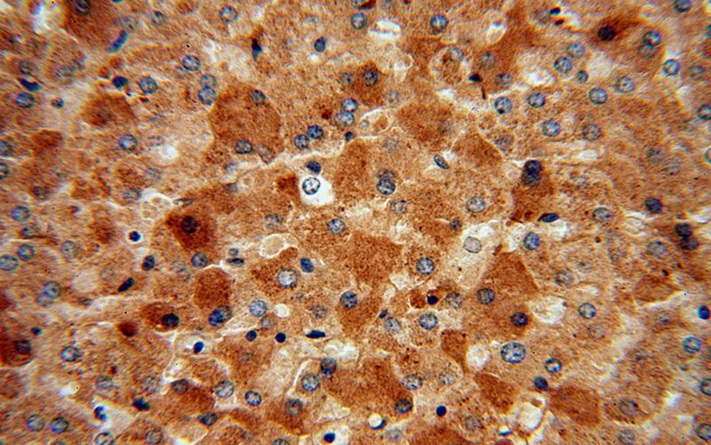 Immunohistochemical of paraffin-embedded human liver using Catalog No:112536(MGAT2 antibody) at dilution of 1:100 (under 40x lens)