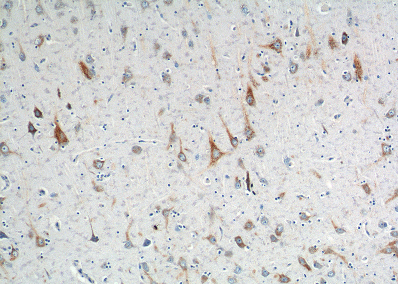 Immunohistochemistry of paraffin-embedded human brain tissue slide using Catalog No:110612(APBB1 Antibody) at dilution of 1:200 (under 10x lens).
