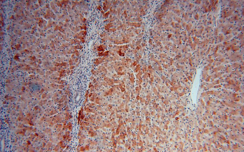 Immunohistochemical of paraffin-embedded human liver using Catalog No:114219(PROS1 antibody) at dilution of 1:100 (under 10x lens)