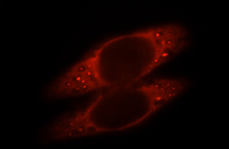 Immunofluorescent analysis of Hela cells, using SLC5A8 antibody Catalog No:115346 at 1:25 dilution and Rhodamine-labeled goat anti-rabbit IgG (red).