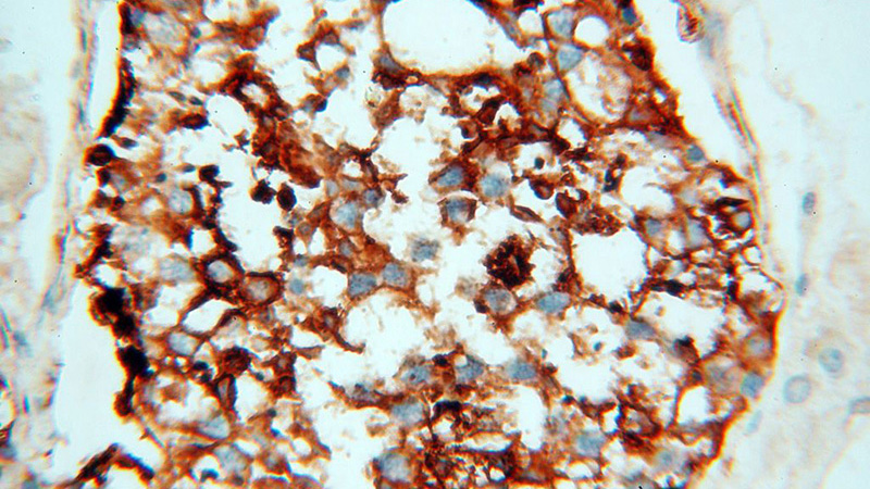 Immunohistochemical of paraffin-embedded human testis using Catalog No:113545(P2RY1 antibody) at dilution of 1:50 (under 40x lens)