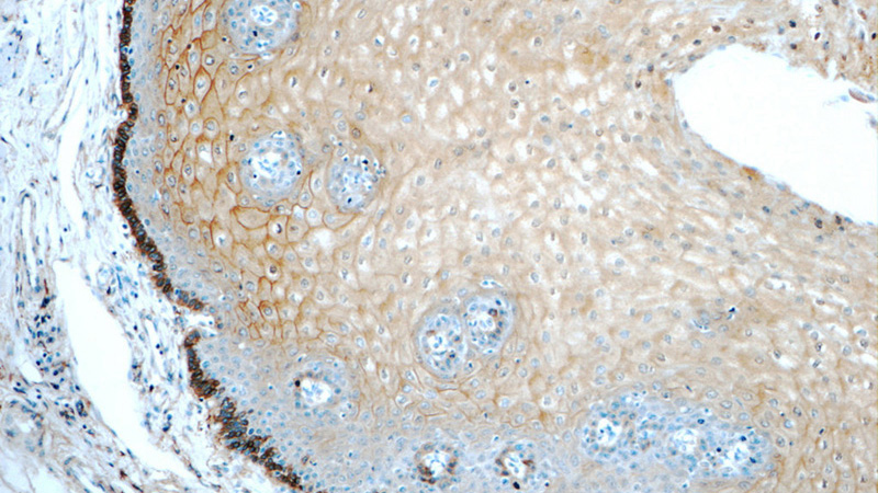 Immunohistochemistry of paraffin-embedded human oesophagus tissue slide using Catalog No:108089(ANXA1 Antibody) at dilution of 1:50 (under 10x lens)