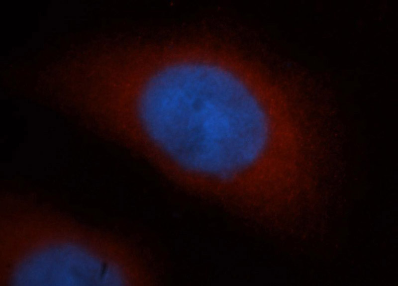 Immunofluorescent analysis of MCF-7 cells, using RNH1 antibody Catalog No:114767 at 1:50 dilution and Rhodamine-labeled goat anti-rabbit IgG (red). Blue pseudocolor = DAPI (fluorescent DNA dye).