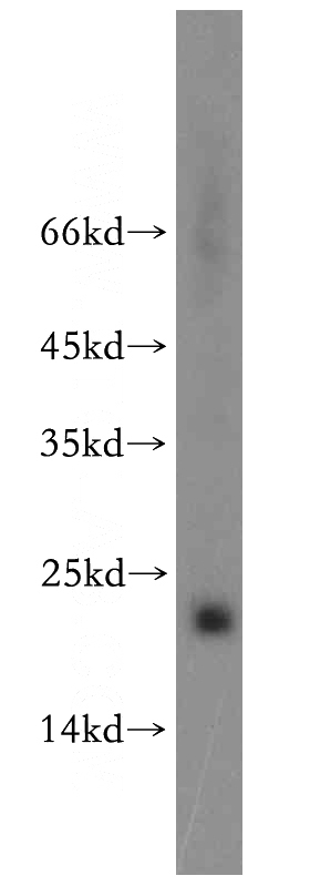 A2780 cells were subjected to SDS PAGE followed by western blot with Catalog No:117096(BCL2L10 antibody) at dilution of 1:200