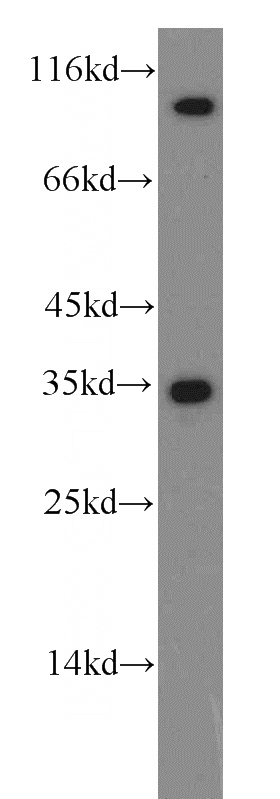 HeLa cells were subjected to SDS PAGE followed by western blot with Catalog No:109157(CDC2-Specific antibody) at dilution of 1:100