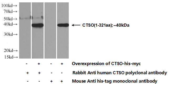Transfected HEK-293 cells were subjected to SDS PAGE followed by western blot with Catalog No:109735(CTSO Antibody) at dilution of 1:700