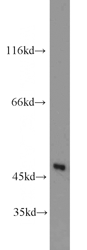human brain tissue were subjected to SDS PAGE followed by western blot with Catalog No:112477(MARCKSL1 antibody) at dilution of 1:600