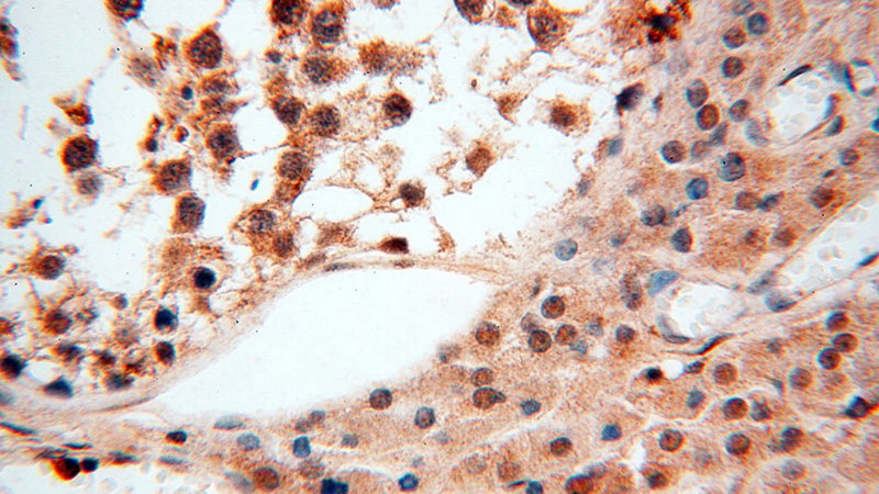 Immunohistochemical of paraffin-embedded human testis using Catalog No:115608(SSH3 antibody) at dilution of 1:100 (under 40x lens)