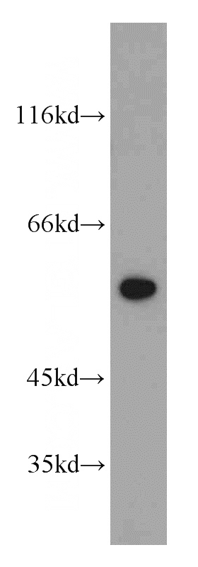 HeLa cells were subjected to SDS PAGE followed by western blot with Catalog No:109083(CCT4 antibody) at dilution of 1:500