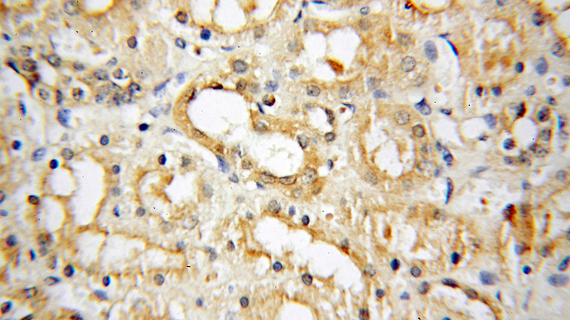 Immunohistochemical of paraffin-embedded human kidney using Catalog No:110123(DUSP9 antibody) at dilution of 1:100 (under 40x lens)