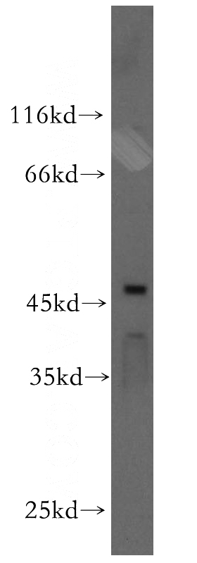 HeLa cells were subjected to SDS PAGE followed by western blot with Catalog No:117242(POU3F2-Specific antibody) at dilution of 1:600