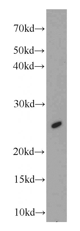 A431 cells were subjected to SDS PAGE followed by western blot with Catalog No:112297(LOR antibody) at dilution of 1:500