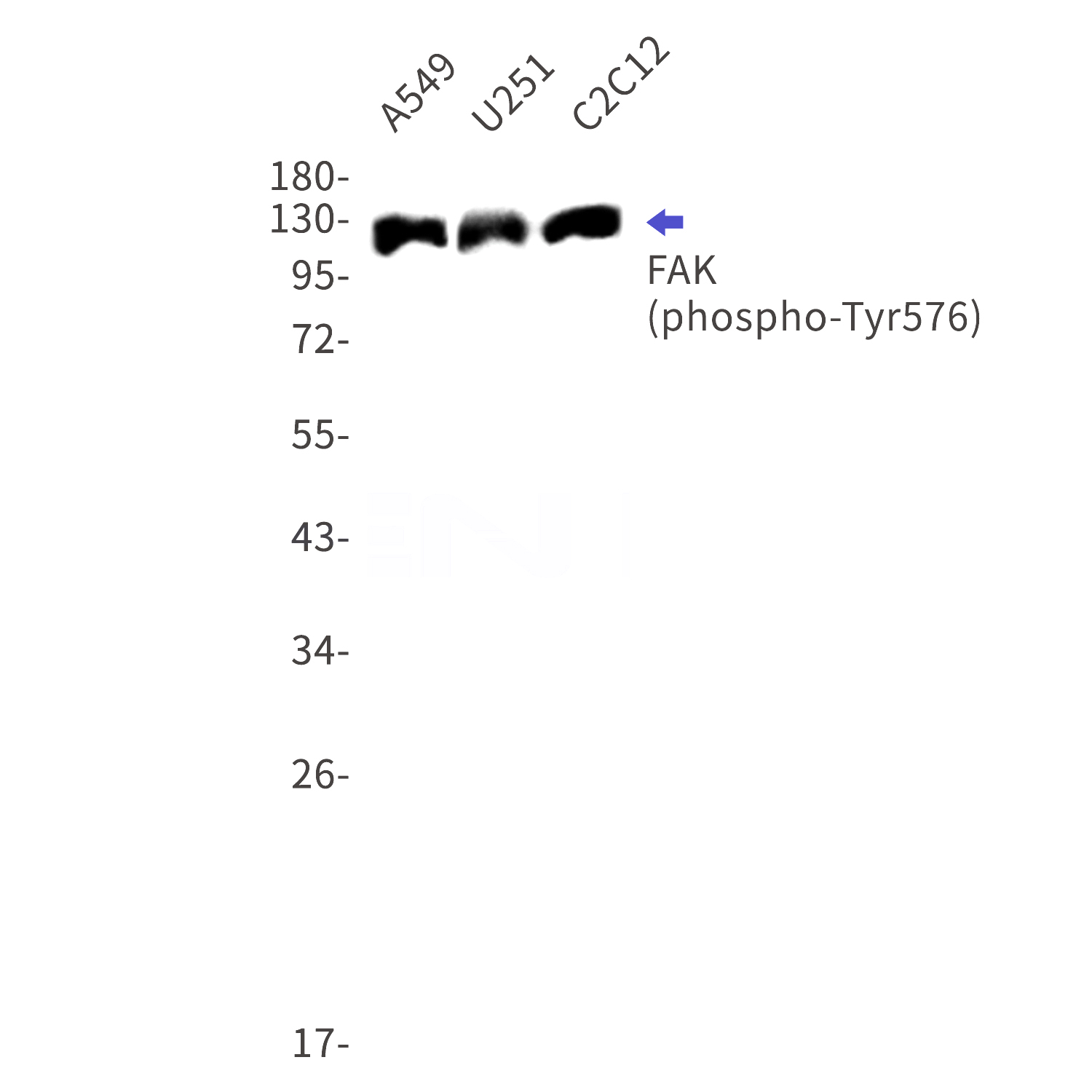 Western blot detection of phospho-FAK (Tyr576) in A549,U251,C2C12 cell lysates using phospho-FAK (Tyr576) Rabbit mAb(1:1000 diluted).Predicted band size:119kDa.Observed band size:125kDa.