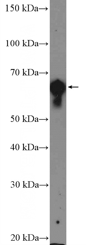 A431 cells were subjected to SDS PAGE followed by western blot with Catalog No:112128(KRT2 Antibody) at dilution of 1:1500