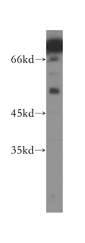 HEK-293 cells were subjected to SDS PAGE followed by western blot with Catalog No:115946(TERF1 antibody) at dilution of 1:300