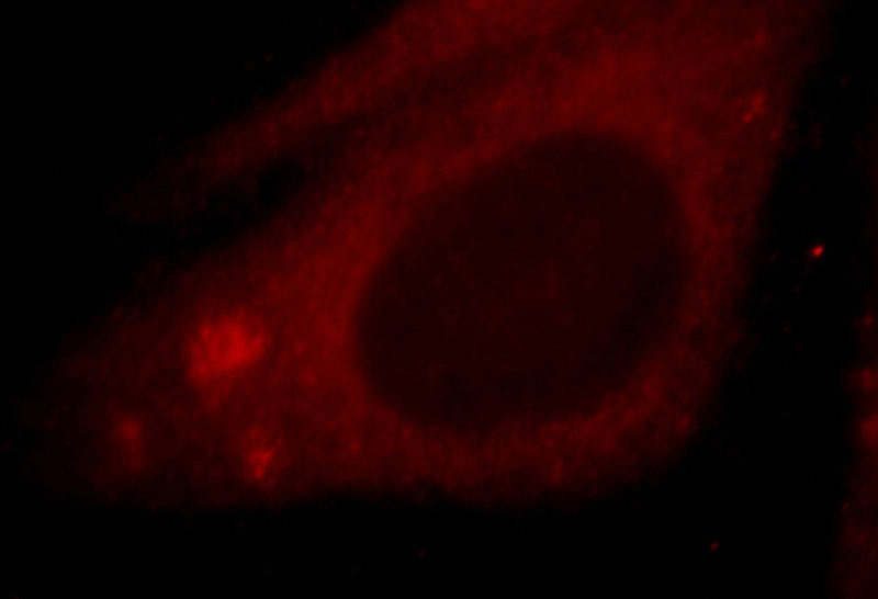 Immunofluorescent analysis of HepG2 cells, using ZNF839 antibody Catalog No:117251 at 1:25 dilution and Rhodamine-labeled goat anti-rabbit IgG (red).