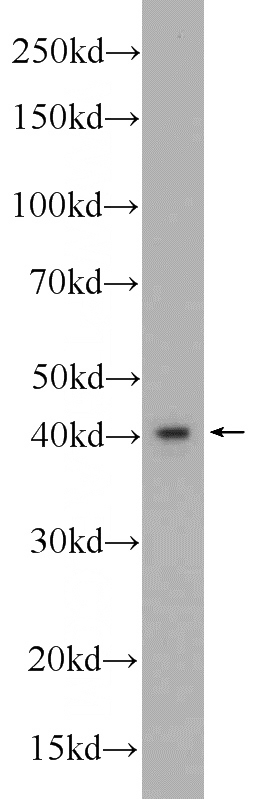 HeLa cells were subjected to SDS PAGE followed by western blot with Catalog No:110551(FBXO28 Antibody) at dilution of 1:1000