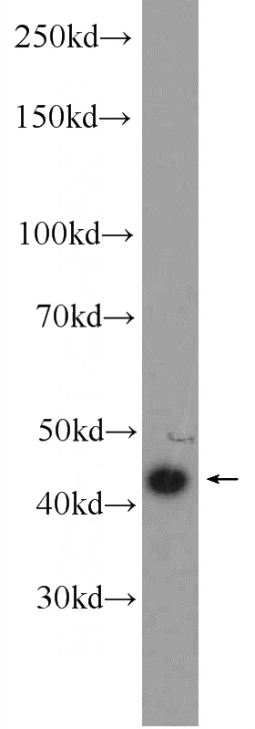 HeLa cells were subjected to SDS PAGE followed by western blot with Catalog No:112288(LMX1B Antibody) at dilution of 1:600