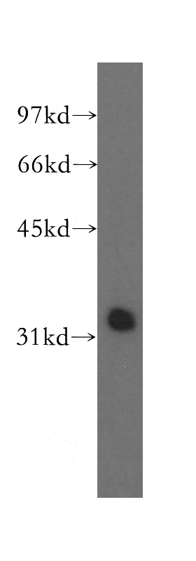 mouse heart tissue were subjected to SDS PAGE followed by western blot with Catalog No:112673(MLF1 antibody) at dilution of 1:500
