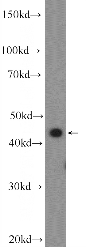 Raji cells were subjected to SDS PAGE followed by western blot with Catalog No:115821(SUDS3 Antibody) at dilution of 1:600