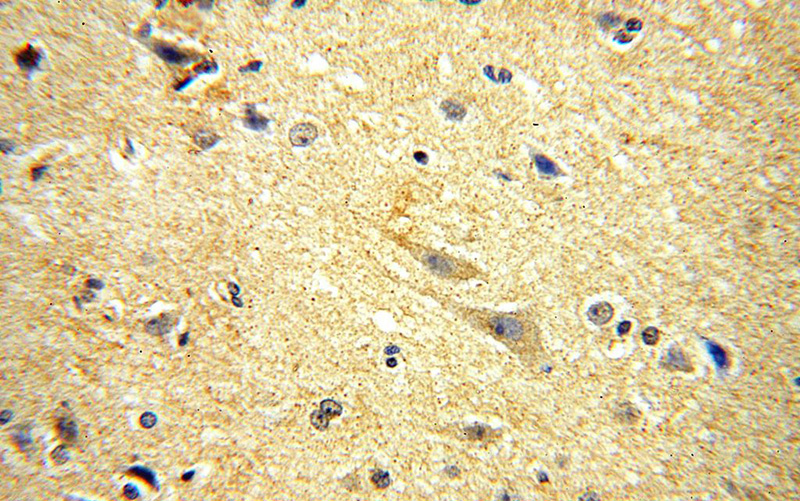 Immunohistochemical of paraffin-embedded human brain using Catalog No:113669(PDE7B antibody) at dilution of 1:100 (under 40x lens)