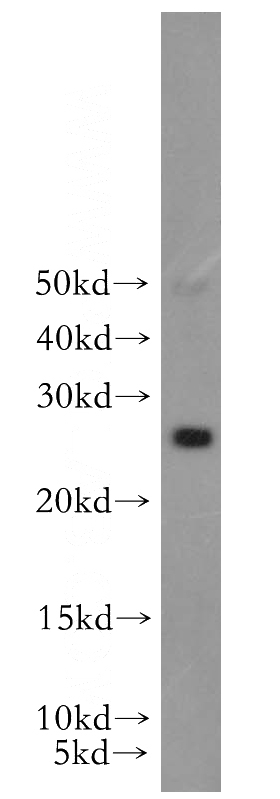 PC-3 cells were subjected to SDS PAGE followed by western blot with Catalog No:114450(RAB41 antibody) at dilution of 1:1000