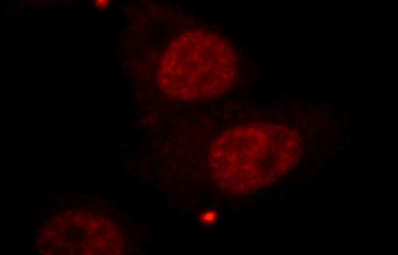 Immunofluorescent analysis of HepG2 cells, using CBLL1 antibody Catalog No:108901 at 1:25 dilution and Rhodamine-labeled goat anti-rabbit IgG (red).