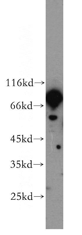 mouse brain tissue were subjected to SDS PAGE followed by western blot with Catalog No:114650(RGS9 antibody) at dilution of 1:500