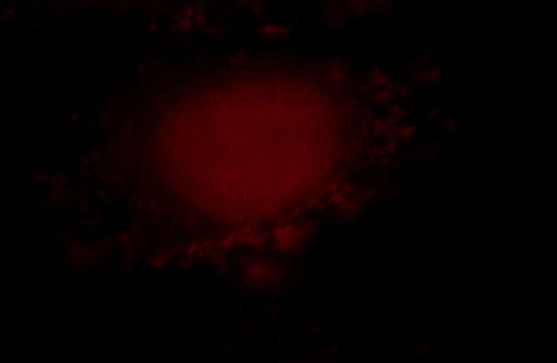 Immunofluorescent analysis of HepG2 cells, using RNF6 antibody Catalog No:114762 at 1:25 dilution and Rhodamine-labeled goat anti-rabbit IgG (red).