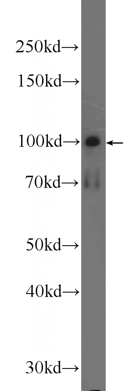 mouse brain tissue were subjected to SDS PAGE followed by western blot with Catalog No:115450(SNCAIP Antibody) at dilution of 1:300