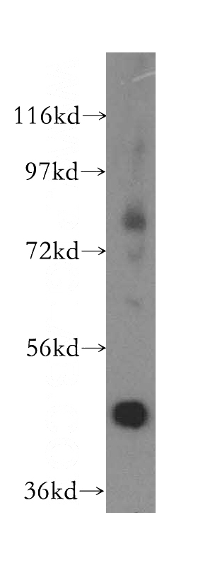 mouse kidney tissue were subjected to SDS PAGE followed by western blot with Catalog No:107719(ACADL-Specific antibody) at dilution of 1:300