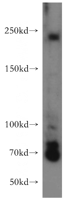HeLa cells were subjected to SDS PAGE followed by western blot with Catalog No:113916(PIP5K3 antibody) at dilution of 1:300