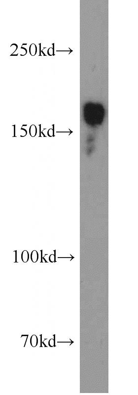 Jurkat cells were subjected to SDS PAGE followed by western blot with Catalog No:115861(TBC1D1 antibody) at dilution of 1:1000