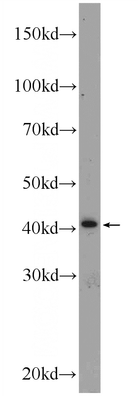 PC-3 cells were subjected to SDS PAGE followed by western blot with Catalog No:115245(SIRT4 Antibody) at dilution of 1:300