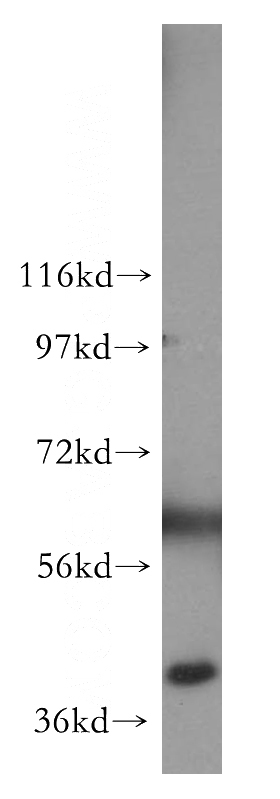 PC-3 cells were subjected to SDS PAGE followed by western blot with Catalog No:113954(PLEK2 antibody) at dilution of 1:500