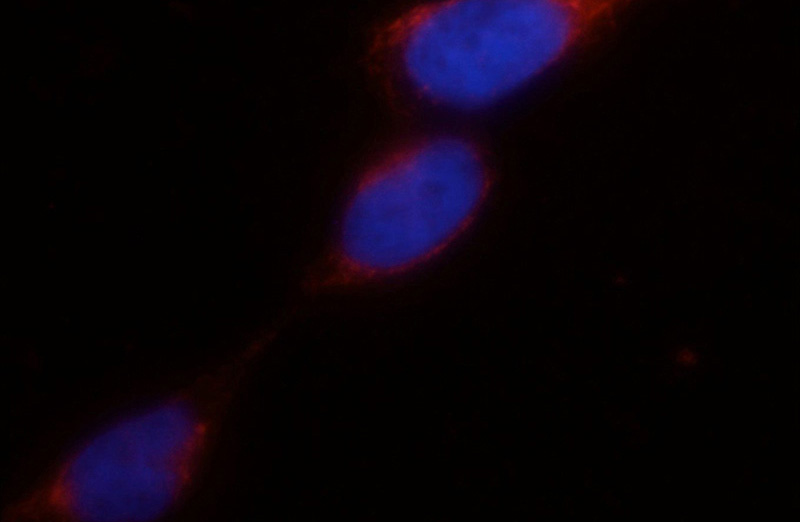 Immunofluorescent analysis of HEK-293 cells using Catalog No:113681(PDI Antibody) at dilution of 1:25 and Rhodamine-Goat anti-Rabbit IgG