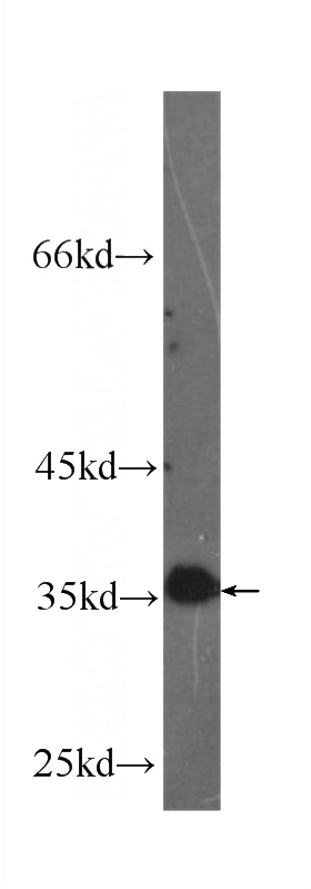 Recombinant protein were subjected to SDS PAGE followed by western blot with Catalog No:107185 at dilution of 1:1000