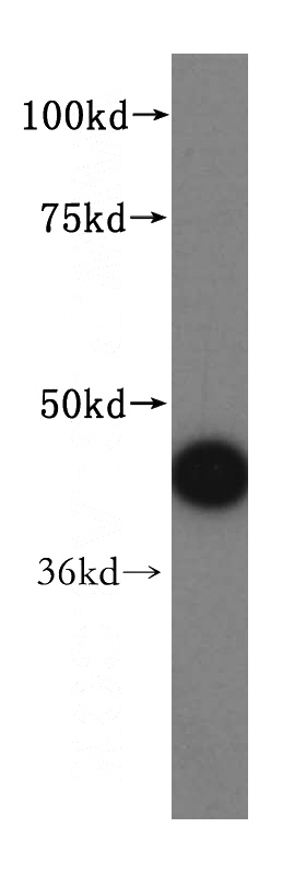 mouse lung tissue were subjected to SDS PAGE followed by western blot with Catalog No:107970(ALDH3B2 antibody) at dilution of 1:500