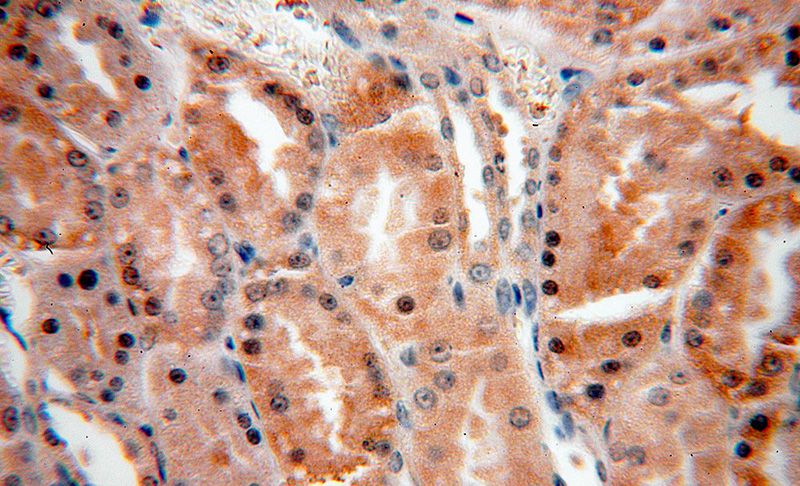 Immunohistochemical of paraffin-embedded human kidney using Catalog No:112438(MAPKAP1 antibody) at dilution of 1:100 (under 40x lens)