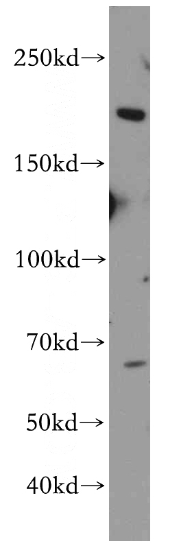 mouse brain tissue were subjected to SDS PAGE followed by western blot with Catalog No:113191(NISCH antibody) at dilution of 1:300