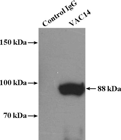 IP Result of anti-VAC14 (IP:Catalog No:116702, 4ug; Detection:Catalog No:116702 1:500) with Jurkat cells lysate 2400ug.