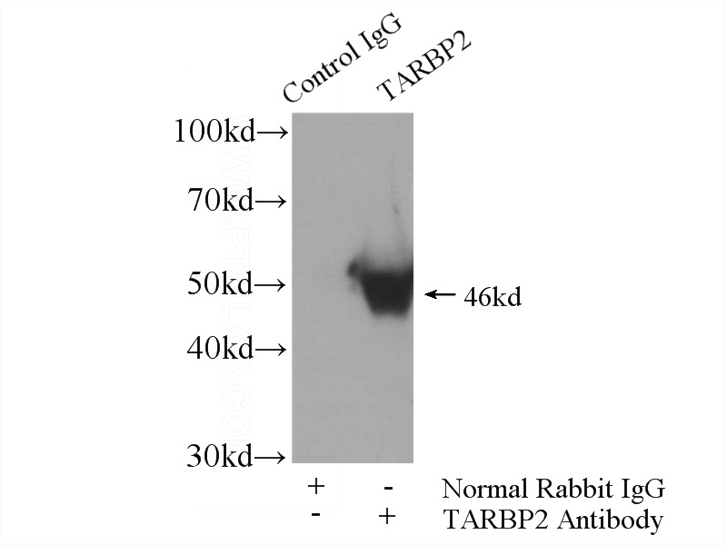 IP Result of anti-TRBP (IP:Catalog No:116352, 4ug; Detection:Catalog No:116352 1:1500) with mouse liver tissue lysate 6400ug.