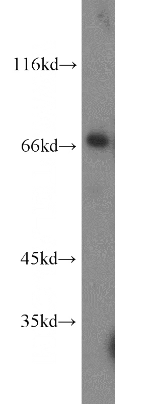 mouse brain tissue were subjected to SDS PAGE followed by western blot with Catalog No:117110(BCRP,ABCG2 antibody) at dilution of 1:300