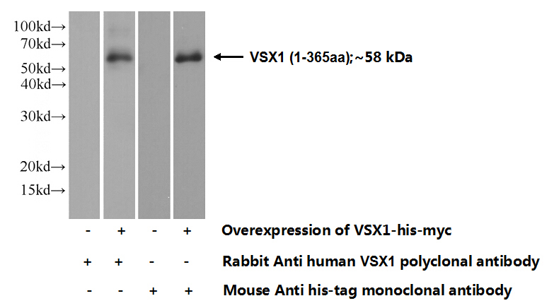 Transfected HEK-293 cells were subjected to SDS PAGE followed by western blot with Catalog No:116803(VSX1 Antibody) at dilution of 1:5000