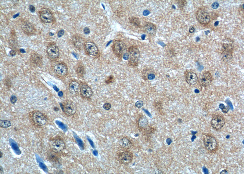 Immunohistochemistry of paraffin-embedded mouse brain tissue slide using Catalog No:108125(AP3M2 Antibody) at dilution of 1:50 (under 40x lens)