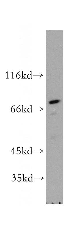 A431 cells were subjected to SDS PAGE followed by western blot with Catalog No:114793(RPA1 antibody) at dilution of 1:200