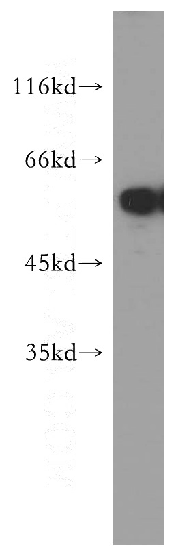 Jurkat cells were subjected to SDS PAGE followed by western blot with Catalog No:116458(TXNRD1 antibody) at dilution of 1:500