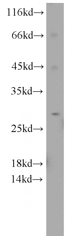 mouse brain tissue were subjected to SDS PAGE followed by western blot with Catalog No:115231(SIKE1 antibody) at dilution of 1:500