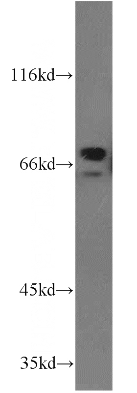 Jurkat cells were subjected to SDS PAGE followed by western blot with Catalog No:117027(ZNF74 antibody) at dilution of 1:1000