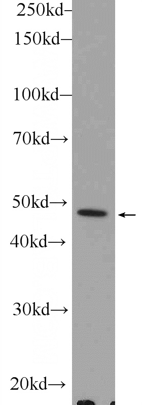 Jurkat cells were subjected to SDS PAGE followed by western blot with Catalog No:113964(PLEKHO1 Antibody) at dilution of 1:300